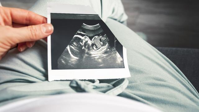 1 haftalık gebelikte beta hCG değeri kaç olmalı? 1 haftalık gebelikte kan testi beta hCG değerleri kaçtır, hamilelikte kan testi nasıl yapılır?