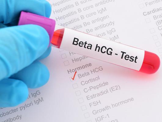 Beta hCG testi 0-5 ne demektir?