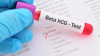 Beta hCG testi 0-5 ne demektir? Beta HCG testi referans aralığı 0-5 nedir, Beta hCG 5 çıktı hamile miyim? 