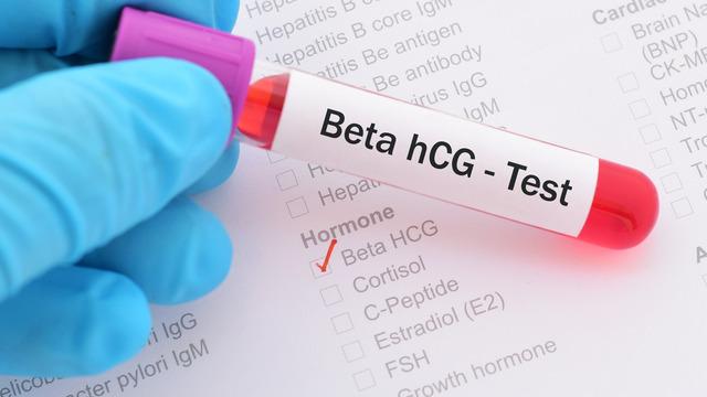 Beta hCG testi 0-5 ne demektir? Beta HCG testi referans aralığı 0-5 nedir, Beta hCG 5 çıktı hamile miyim? 