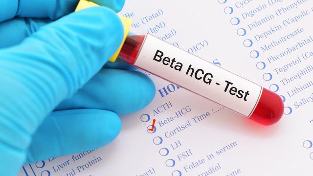 Beta hCG değeri 1.20 çıktı, hamile miyim? Beta hCG testi 1.20 ne demektir, kanda beta hCG değeri kaç olursa hamile olunur?