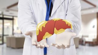 Karaciğer yağlanmasına ne iyi gelir, yağlanmayı gidermek için ne yapmak gerekir? Karaciğer yağlanması belirtileri nelerdir ve nasıl geçer?