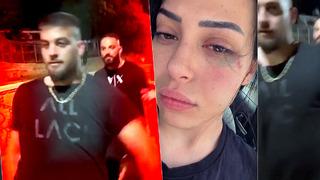 Önce taciz ettiler, Türk olduğunu anlayınca duvardan aşağı atıp bayılttılar! GKRY'de çirkin saldırı: Sosyal medyadan görüntüleri paylaştı