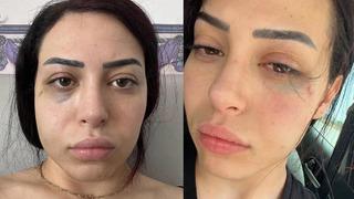 GKRY'de Türk kızına önce taciz sonra saldırı! Asya Karaali'nin duvardan itildiği anların görüntüleri ortaya çıktı!