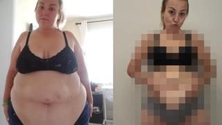 107 kilo veren kadın değişimiyle gelen zorlukları paylaştı! Cinsel hayatımı bitirdi