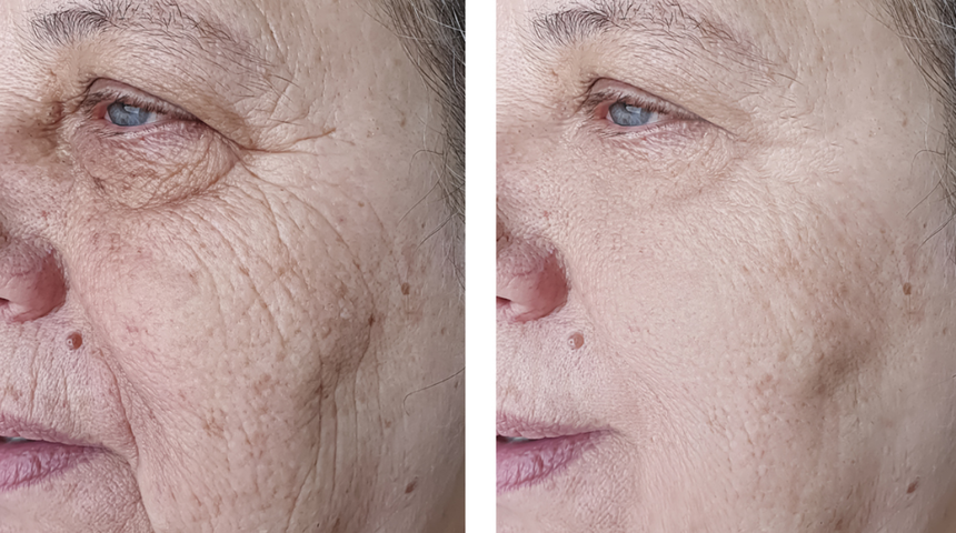 Kırışıklıkları bir gecede azaltıyor! D&uuml;zenli kullanımda gen&ccedil;leştiriyor