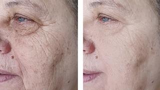 Kırışıklıkları bir gecede azaltıyor! Düzenli kullanımda gençleştiriyor