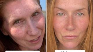 En az 20 yaş gençleşmesini sağlayan doğal güzellik bakımını açıkladı! Her gece yatmadan önce...