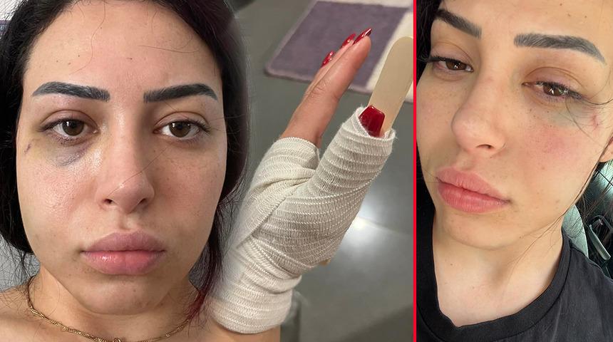 GKRY'de Türk kızı Asya Karali saldırıya uğramıştı! Yaşadıklarını anlattı: 'Olayın gerçekleşmesindeki en büyük unsur...'