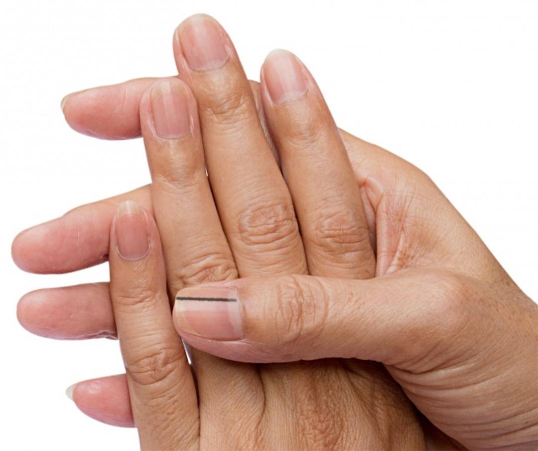 Bu sinyaller tehlikeli bir hastalığın habercisi olabilir