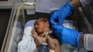 İsrail hapishanesinde Filistinli mahkumun eşi “sperm kaçırma” yöntemiyle hamile kaldı... Dördüzlerini doğurdu