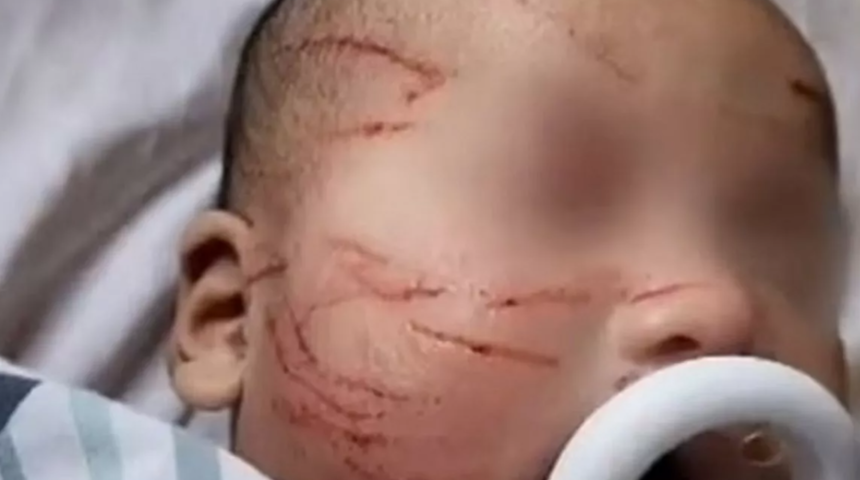 Bebeğini kreşten aldığında gördüklerine inanamadı! Yüzündeki çizikleri görünce dehşete kapıldı