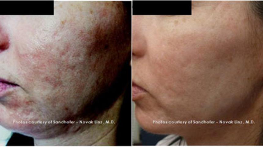 Y&uuml;z&uuml;n&uuml;zde "Altın" D&ouml;nem