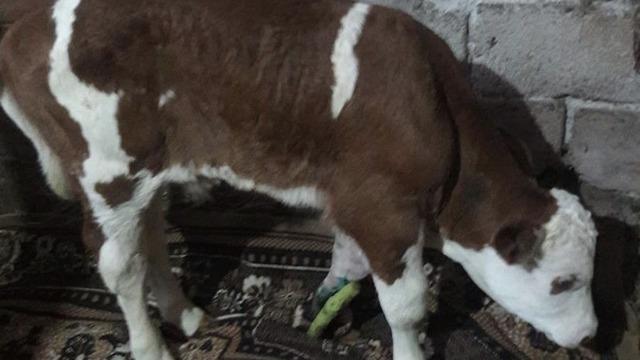 Doğum esnasında ayağı kırıldı, ayağına 6 platin takıldı