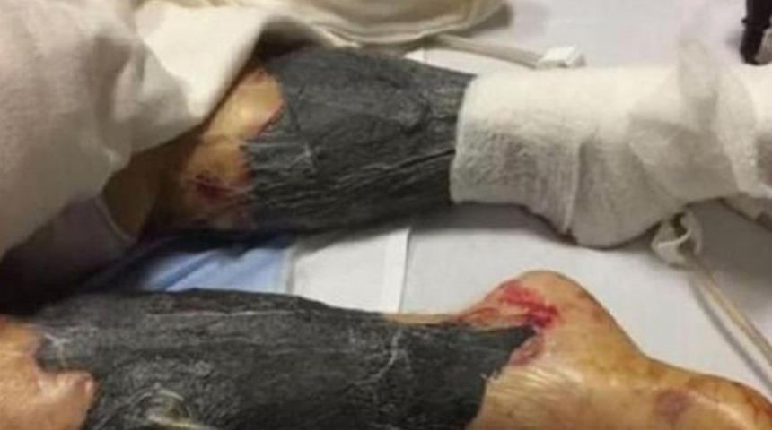 Pazardan aldığı gibi yedi hayatını kaybetti!