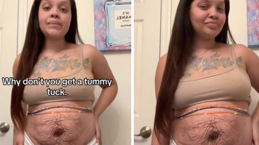 Doğumdan sonra karnında yaşadığı değişimleri cesurca gösteriyor! "Utanmıyorum"