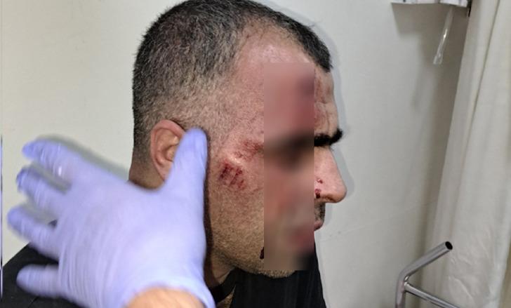 Gazeteci Sinan Aygül sokak ortasında saldırıya uğradı! Polis memuru ve belediye çalışanı açığa alındı