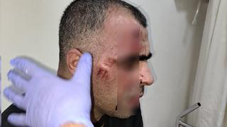 Gazeteci Sinan Aygül sokak ortasında saldırıya uğradı! Polis memuru ve belediye çalışanı açığa alındı