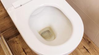 Sararan tuvalet taşlarını bembeyaz yapıyor! Kireç tutmuş tuvaleti temizlemenin kolay yolu