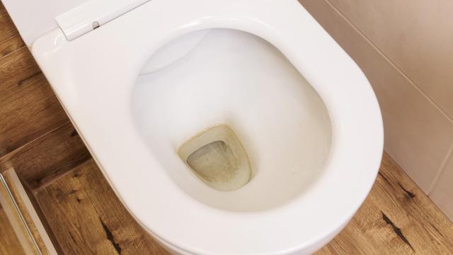 Sararan tuvalet taşlarını bembeyaz yapıyor! Kireç tutmuş tuvaleti temizlemenin kolay yolu