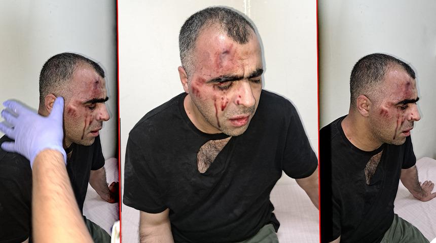Gazeteci Sinan Aygül'ü hastanelik etmişlerdi! Bitlis'teki darp olayında belediye çalışanı ve polis memuru tutuklandı
