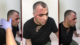 Gazeteci Sinan Aygül'ü hastanelik etmişlerdi! Bitlis'teki darp olayında belediye çalışanı ve polis memuru tutuklandı