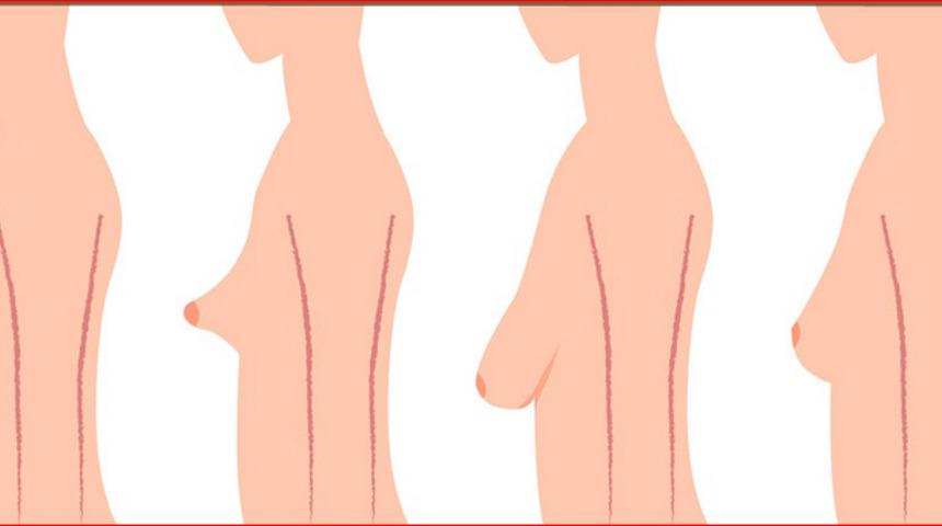 Kadınlar neden meme estetiği yaptırıyor ?