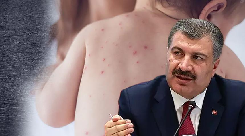 Son dakika | 'Kaygı uyandıran iddialar' diyerek detayları paylaştı: Bakan Koca'dan "kızamığa bağlı ölüm" açıklaması! O hastanın vefat nedenini açıkladı