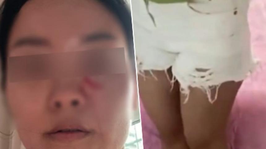 Gelin ve kayınpeder arasındaki şort kavgası kabusa döndü! Şortunu kısa bulduğu gelinin üzerine sıcak çorba döktü