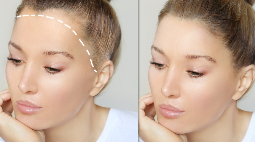 Saç dökülmesini durduran en etkili yöntem! Yeni saçların çıkması için şampuanınıza ekleyin