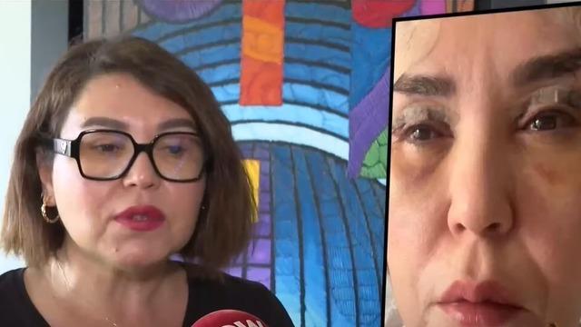 Ünlü gazeteci Esin Övet’e göz estetiği şoku! Tek gözü kör oldu, diğerinde ise görme kaybı var…