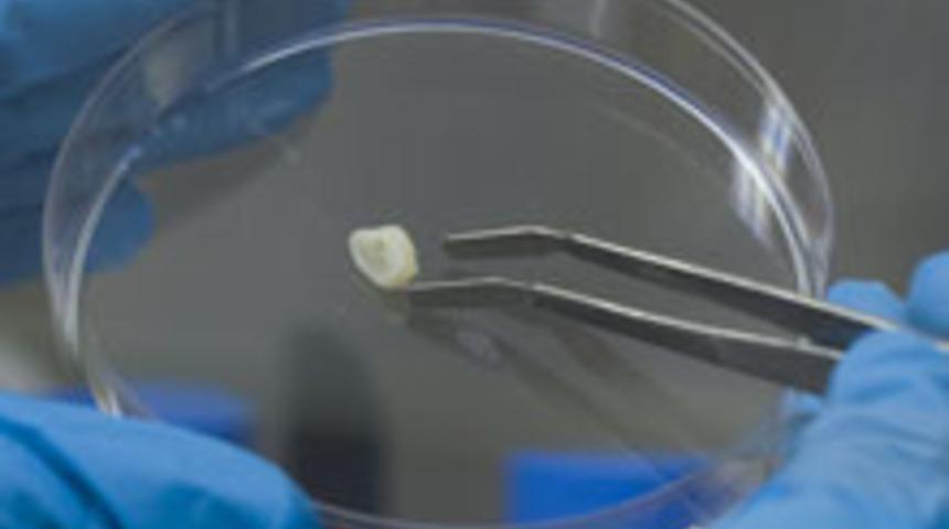 Diş çekimi sonrasında ve öncesinde nelere dikkat etmek gerekiyor?