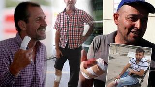 Birçok ilden görüntüler geldi... Acemi kasaplar hastanelik oldu! Soluğu acilde aldılar