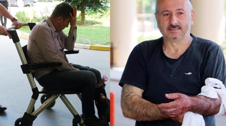 Acil servisler doldu taştı! Bayramda acemi kasapların bilançosu: 4 bin 877 yaralı