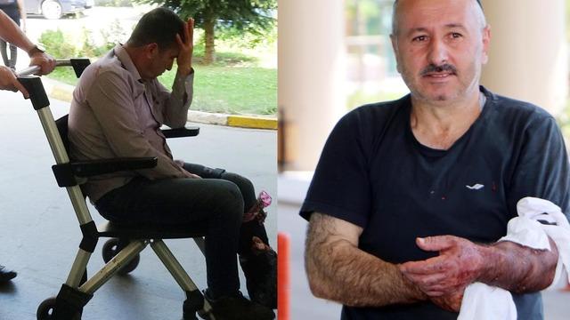 Acil servisler doldu taştı! Bayramda acemi kasapların bilançosu: 4 bin 877 yaralı