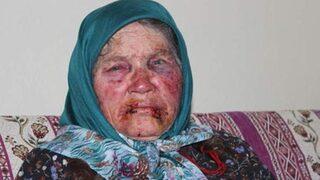 Yaşlı kadını darp ve gasp eden vicdansız yakalandı