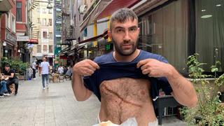 Taksim'de dehşeti yaşadı, defalarca bıçaklandı! Ölümden dönen esnaf o anları anlattı: Gözbebeklerinin büyümüş olduğunu gördüm