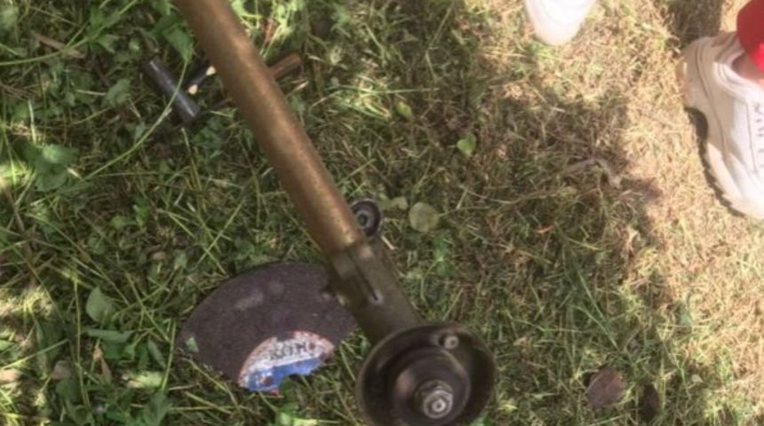 Kabus dolu anlar! Çim biçme makinesiyle yanlışlıkla cinsel organını kesen bahçıvan kan kaybından hayatını kaybetti... Cansız bedeni ormanda bulundu