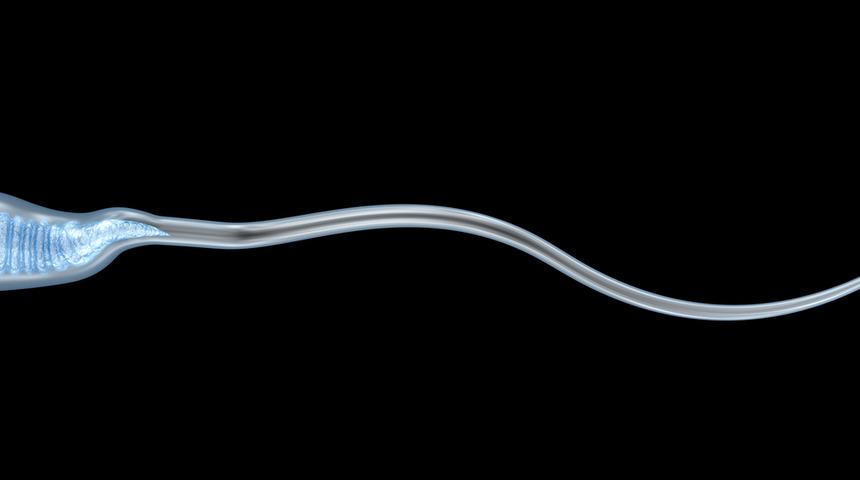 Sperm kalitesi sperm sayısından daha &ouml;nemli 