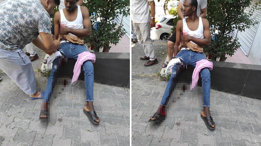 'Yanlış zil' dehşeti! Zili karıştırınca hem bı&ccedil;aklandı hem de vuruldu