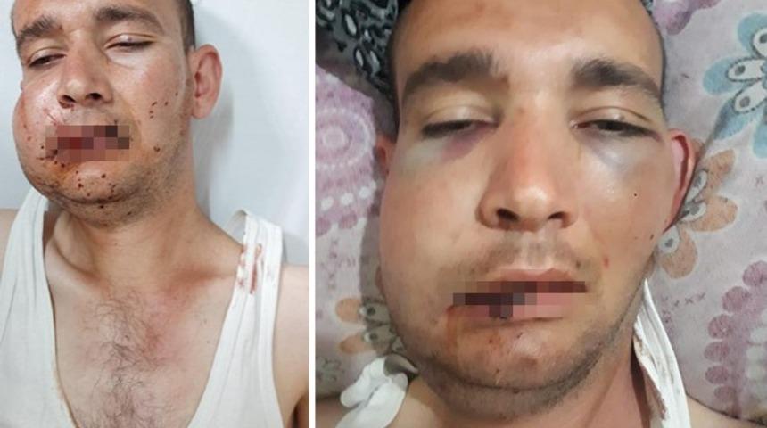 Kas hastası genci döverek hastanelik etti! Sebebi 'pes' dedirtti