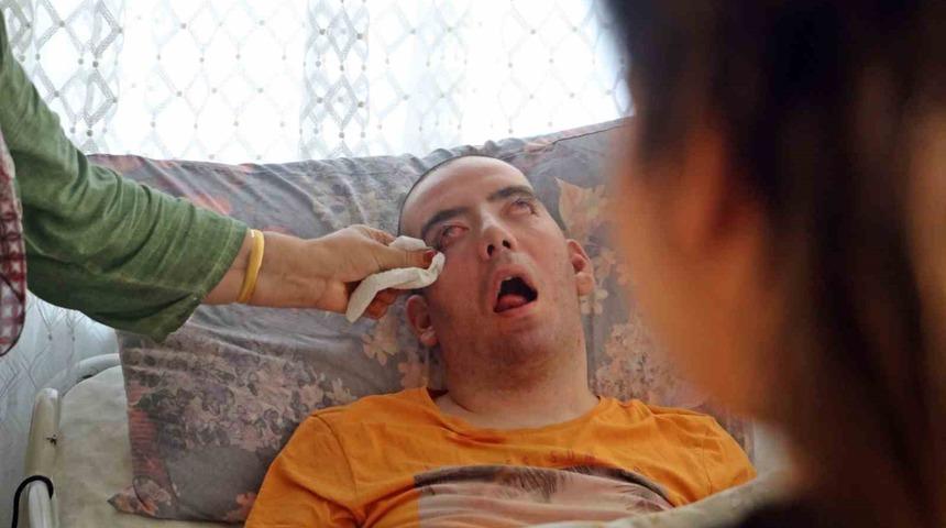 Doktorlar 6 ay ömür biçti, 10 yıldır yaşam savaşı veriyor! 'Görünce canım yanıyor'