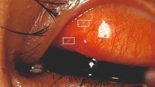 Kızarıklık ve yanma şikayetiyle doktora gitti, gözünden çıkanlar şoke etti