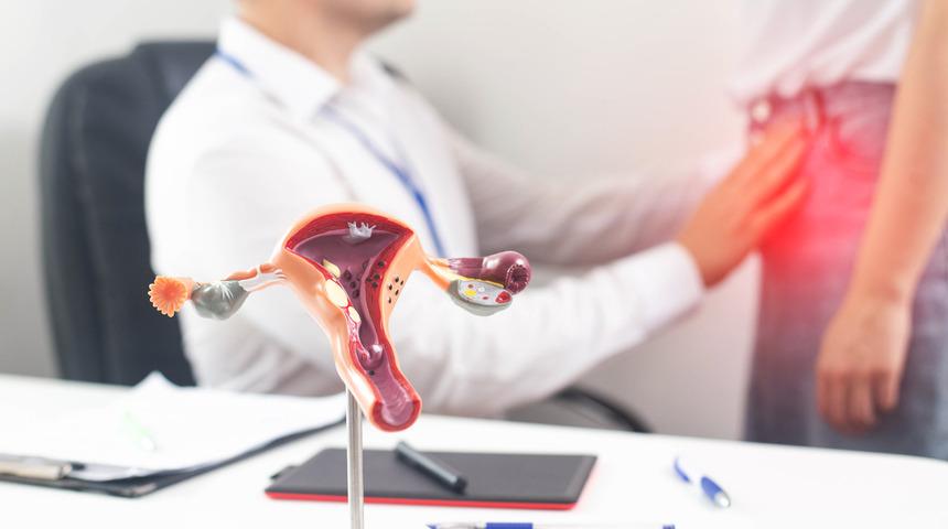 Çikolata kisti nedir, belirtileri nelerdir? Çikolata kisti neden olur, tedavisi nasıl yapılır?