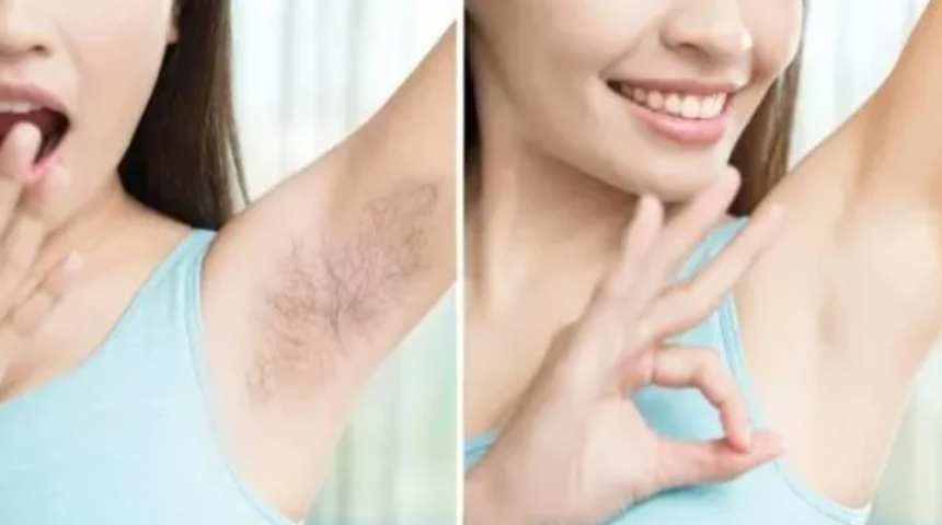 2 malzeme ile istenmeyen tüylerden sonsuza dek kurtulun! Epilasyon ve ağda etkisi yaratıyor