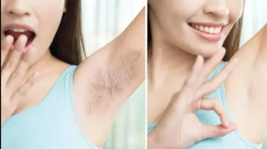 İstenmeyen tüylerden sonsuza kadar kurtulun! Hem acısız hem de masrafsız