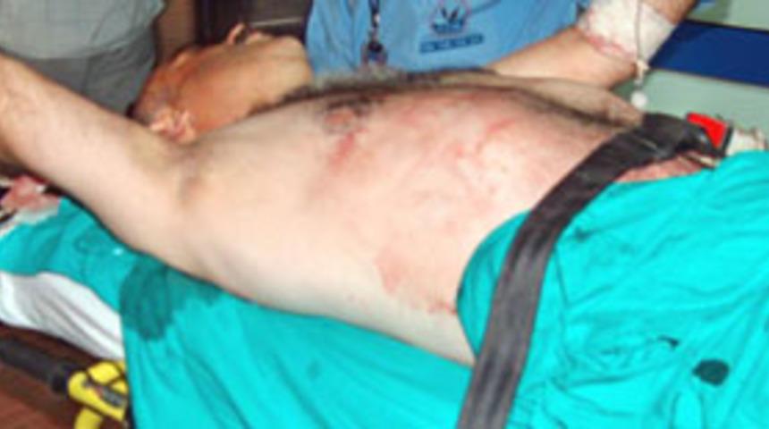 Piknik tartışması kanlı bitti