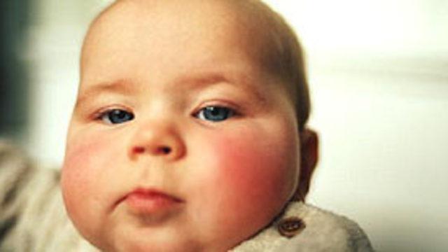 Bebeklerde görülen ishal öldürüyor