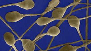 Kök hücreden sperm ve yumurtalık