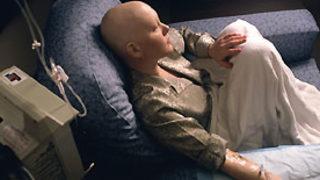 Mide kanseri, öldüren kanserlerde ikinci